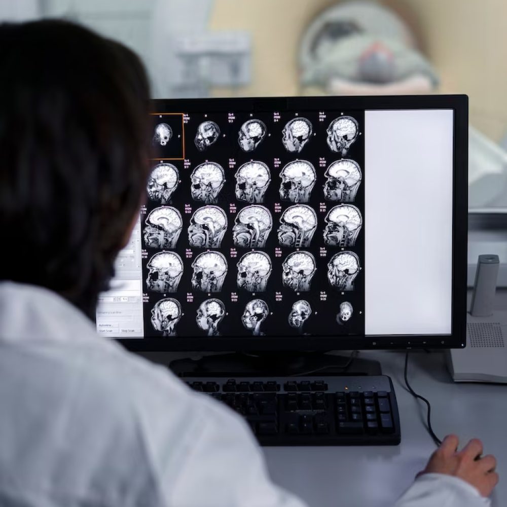 doctor-mirando-encima-tomografia-computarizada_23-2149367460